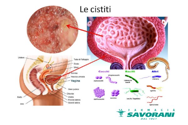 cistite savorani - tisana al rosmarino